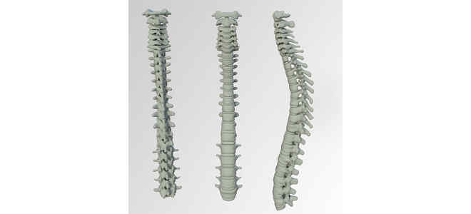bone