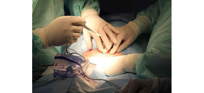 intestinal