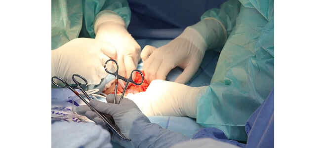 intestinal
