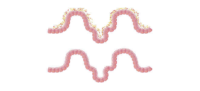 parasite